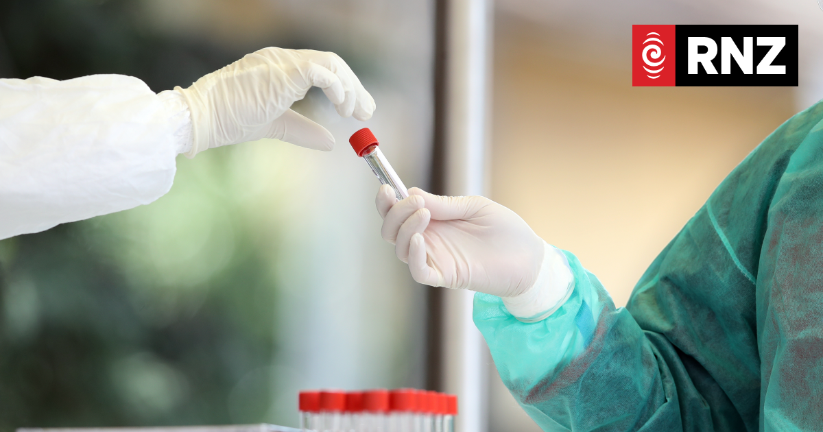DIY testing for STIs? - Vimarsana News