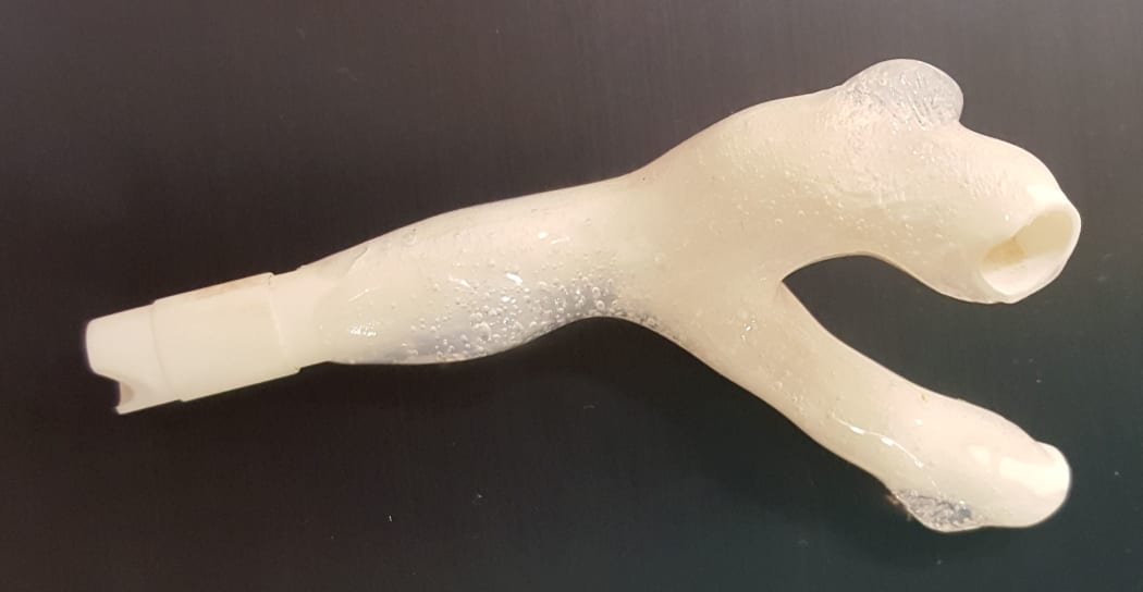 A scaled-up 3D printed model, based on a real coronary artery.
