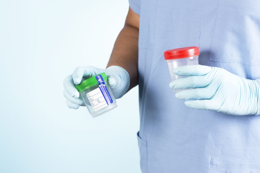 Urine cup drug test drug testing