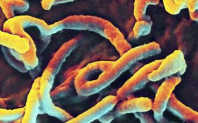 A patient is being tested for the deadly Ebola virus in a hospital in Western Australia