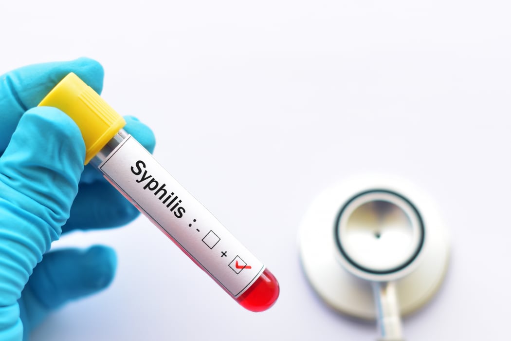Blood sample positive with syphilis