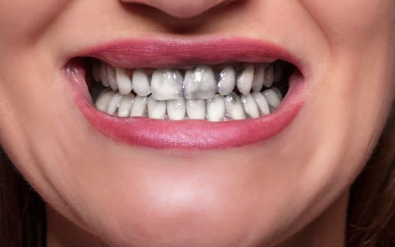 Close-up Of Woman Cleaning Her Teeth With Charcoal Tooth Paste