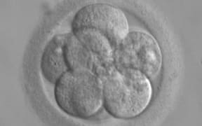 A human embryo, here seen in its eight-cell stage, doubles its number of cells at each division.